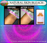 Skin Bleach & Spot Lightening