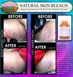 Skin Bleach & Spot Lightening