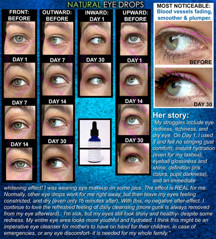 Natural Eye Drops, Eyeball Health