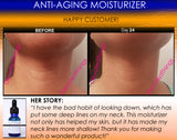 Anti Aging Moisturizer For Dry Skin, Wrinkles, Age Spots, Freckles, and Pore Shrinking - DevotedThings