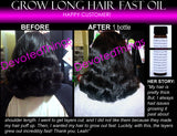 Grow Long Hair Fast Hair Growth Oil Hair Growth Serum Scalp Energizer Rare Oils