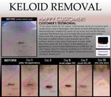 Bump Removal 3-Day Peel