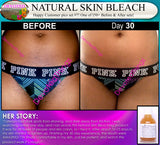 Natural Skin Bleaching Product That Works (Acne Scar Lightening, African American Skin, Hyperpigmentation Spots) - DevotedThings