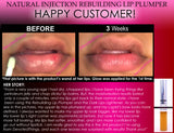 Natural Injection Lip Plumping Gloss Extreme Rebuilding Lip Plumper That Works Clear Color - DevotedThings