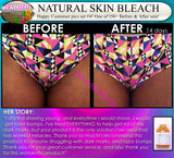 Natural Skin Bleaching Product That Works (Acne Scar Lightening, African American Skin, Hyperpigmentation Spots) - DevotedThings