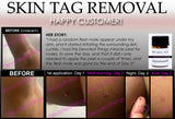 Bump Removal 3-Day Peel