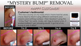 3 Day Peel For HPV Warts, Plantar Warts, Moles, Skin Tags, and Keloid Scars Removal Deepest Gentle Acid - DevotedThings