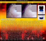 Treatment for Indented Scars Acne Chicken Pox Pitted Scar Removal Peel With Hyaluronic Acid - DevotedThings