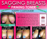 Beautiful Chest Kit for Women for Sagging Breasts Freckles Moles Skin Tags Beauty Set of 3 - DevotedThings