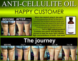 All Natural Anti Cellulite Oil Treatment That Works For Thighs with Caffeine and Essential Oils - DevotedThings