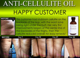 All Natural Anti Cellulite Oil Treatment That Works For Thighs with Caffeine and Essential Oils - DevotedThings