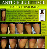 All Natural Anti Cellulite Oil Treatment That Works For Thighs with Caffeine and Essential Oils - DevotedThings