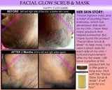 Facial Glow Daily Cleanser Acne Scars Skin Bleaching Soap, Scrub, Mask Natural Herbal Bleach - DevotedThings