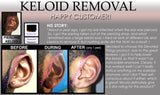 3 Day Peel For HPV Warts, Plantar Warts, Moles, Skin Tags, and Keloid Scars Removal Deepest Gentle Acid