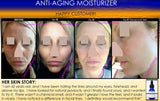 Anti Aging Moisturizer For Dry Skin, Wrinkles, Age Spots, Freckles, and Pore Shrinking - DevotedThings