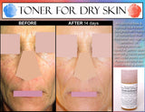Natural Alcohol free Toner for Women with Dry, Sensitive, Combination, or Aging Skin with Rosewater, Calendula, and Moisturizing Herbal Extracts - DevotedThings