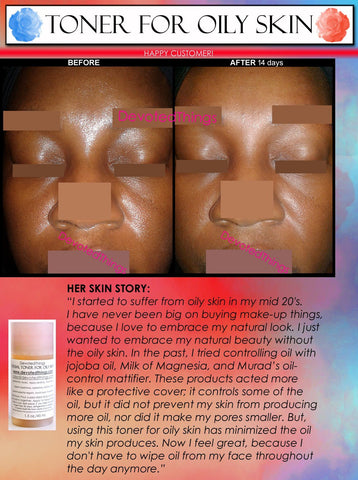 Alcohol free Herbal Toner For Oily Skin and Acne with Salicylic Acid, Lemon, and Natural Cleansing Enzymes - DevotedThings