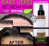 Super Fast Hair Growth System Natural Hair Growth Products Kit Set of 3 - DevotedThings