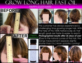 Grow Long Hair Fast Hair Growth Oil Hair Growth Serum Scalp Energizer Rare Oils - DevotedThings