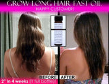 Grow Long Hair Fast Hair Growth Oil Hair Growth Serum Scalp Energizer Rare Oils - DevotedThings