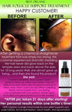Organic Herbal Hair Loss Treatment, Hair Regrowth Support, and Anti Dandruff Spray - DevotedThings