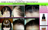 Organic Herbal Hair Loss Treatment, Hair Regrowth Support, and Anti Dandruff Spray - DevotedThings