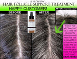 Organic Herbal Hair Loss Treatment, Hair Regrowth Support, and Anti Dandruff Spray - DevotedThings