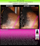 Organic Herbal Hair Loss Treatment, Hair Regrowth Support, and Anti Dandruff Spray - DevotedThings