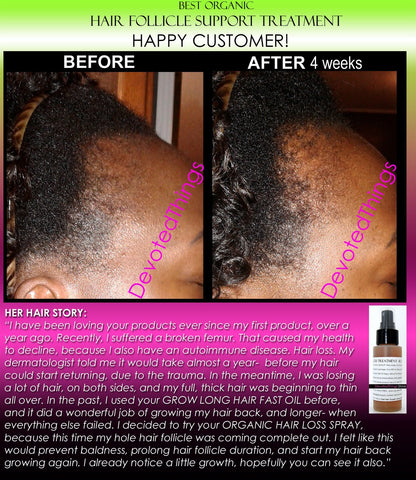 Organic Herbal Hair Loss Treatment, Hair Regrowth Support, and Anti Dandruff Spray - DevotedThings