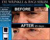 Natural Skin Care Kit Anti Aging For Wrinkles Anti Wrinkle Complete Set of 6 - DevotedThings