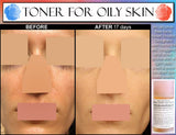 Natural Skin Care Kit For Teens and Oily Skin Set of 3 - DevotedThings