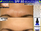 Natural Skin Care Kit For Teens and Oily Skin Set of 3 - DevotedThings