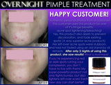 Overnight Pimple Treatment for Zits, Boils, Cysts Fast Remedy - DevotedThings