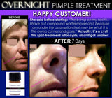 Overnight Pimple Treatment for Zits, Boils, Cysts Fast Remedy - DevotedThings
