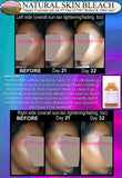 Natural Skin Bleaching Product That Works (Acne Scar Lightening, African American Skin Hyperpigmentation Spots)