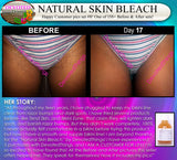 Natural Skin Bleaching Product That Works (Acne Scar Lightening, African American Skin, Hyperpigmentation Spots) - DevotedThings