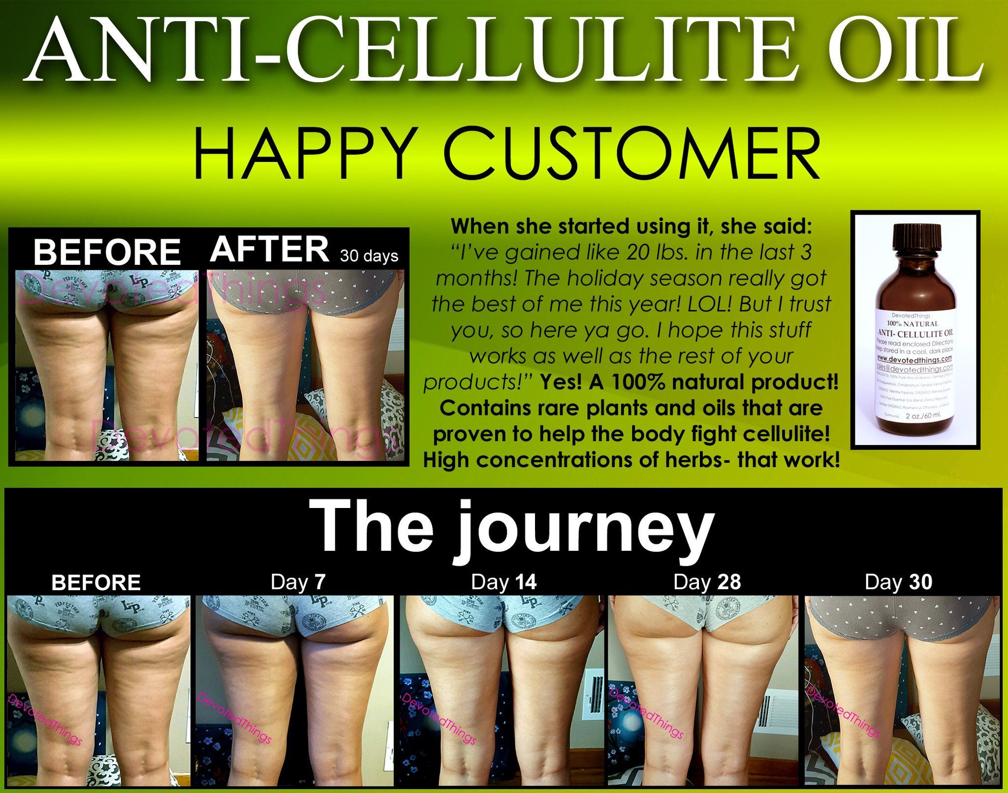 Anti-Cellulite Treatment