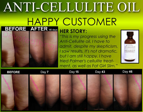 All Natural Anti Cellulite Oil Treatment That Works For Thighs with  Caffeine and Essential Oils