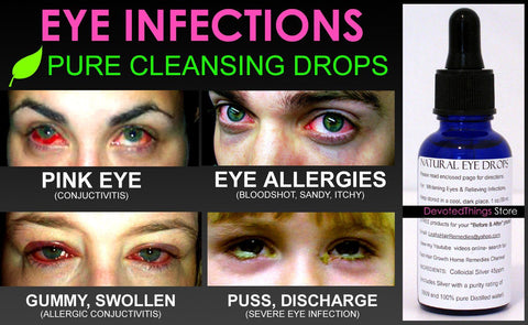 Natural Eye Drops for Pink Eye and Eye Infections for Healthy Bright Eyes - DevotedThings