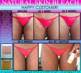 Womens Natural Hips Zone Kit for Stretch Marks Lightening Private Areas Cellulite Set of 3 - DevotedThings