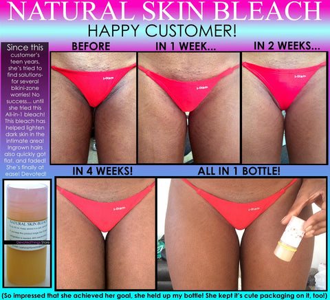 Womens Natural Hips Zone Kit for Stretch Marks Lightening Private Areas  Cellulite Set of 3