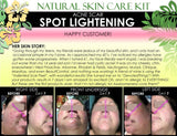 Natural Skin Care Kit For Acne Scar Spot Lightening and Acne Care Complete Set of 6 - DevotedThings