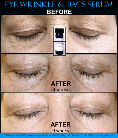 Natural Eye Wrinkle Treatment & Eye Bags Treatment 2 IN 1 Product - DevotedThings